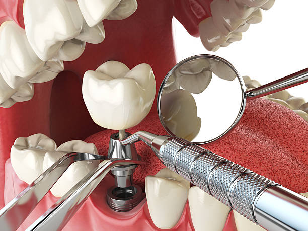 Best Emergency Dentist for Special Needs Patients in Amityville, NY